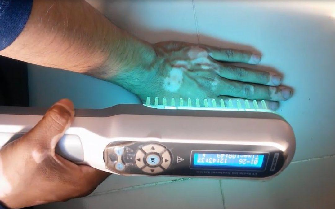 UVB Phototherapy Clinic SKINFUDGE® - Center of Skin & Hair Excellence